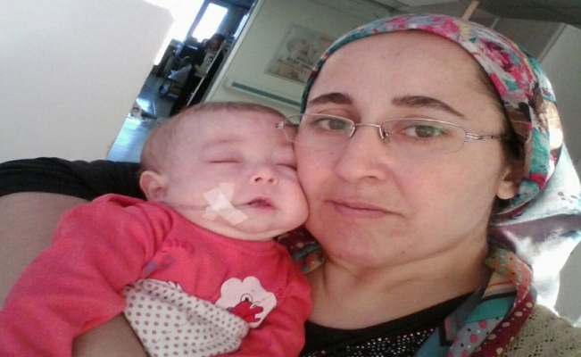 7 aylık Tuana bebeğin yaşam mücadelesi