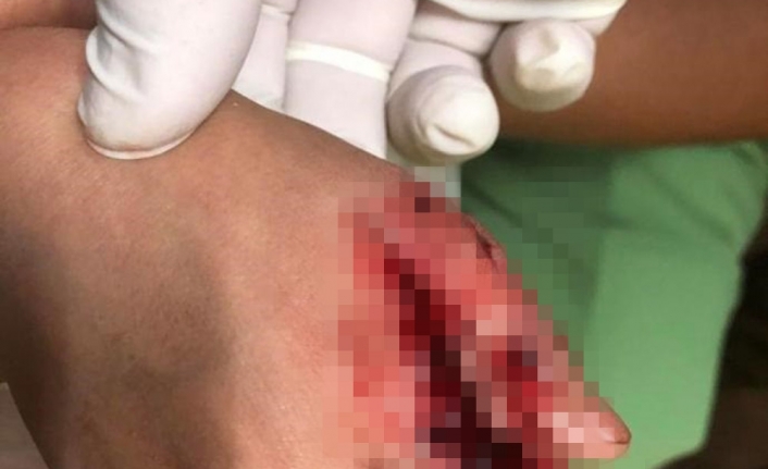 Çin’de bir AVM’de köpek balığı küçük kıza saldırdı