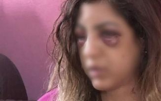 Aldattı, barışmayan eşini bu hale getirdi