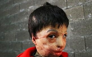Esad’ın varil bombası 7 yaşındaki Mahmud’u...
