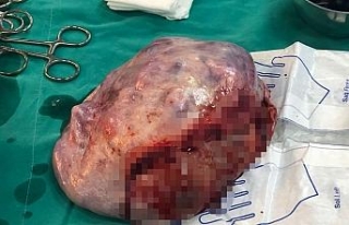 19 yaşındaki genç kızın karnından çıktı